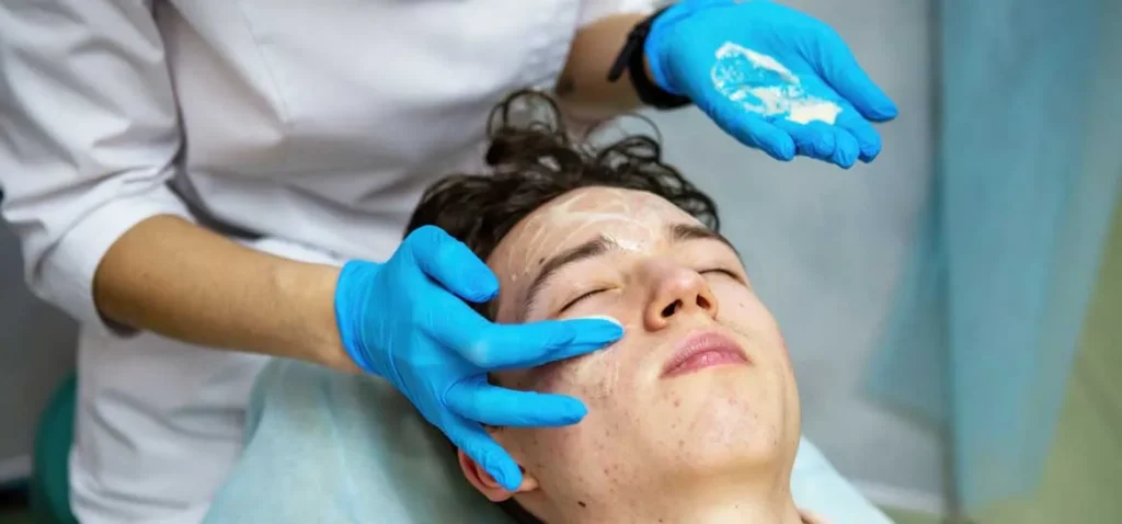 acne en adolescentes